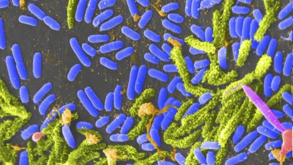 Sanidad llama a la calma sobre el caso de cólera y precisa que se trata de una gastroenteritis