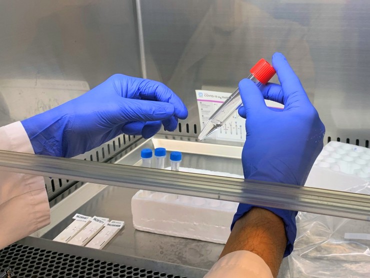 Un sanitario realiza una prueba PCR.
