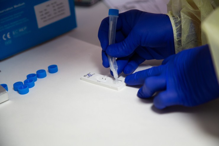 Test de antígenos para la detección de la COVID-19.