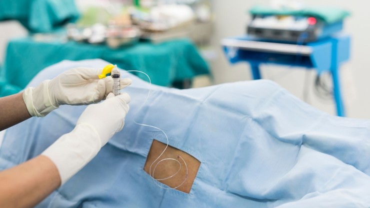 Un anestesista administra la epidural a un paciente.