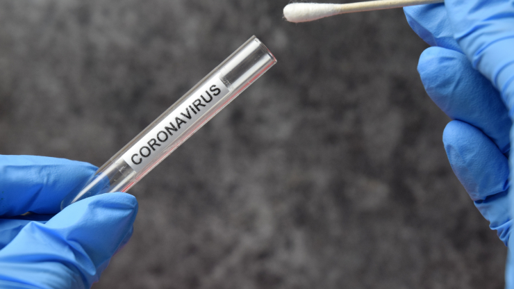 Imagen de un test diagnóstico de coronavirus.