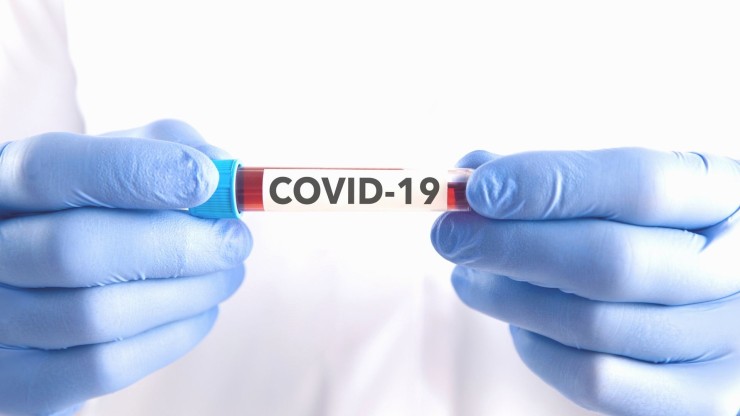 Muestra de sangre de un paciente con COVID-19.