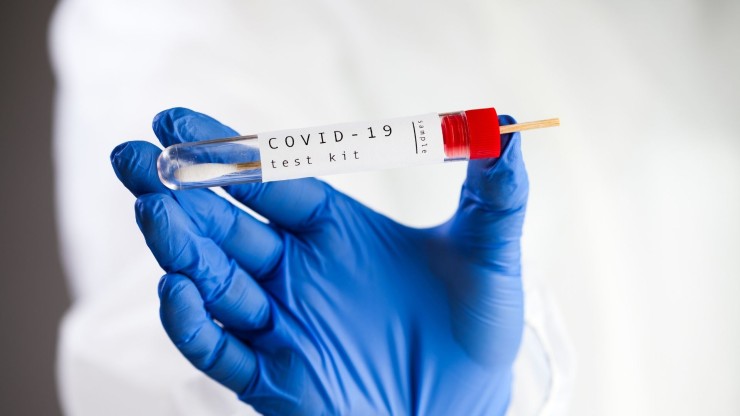 Test diagnóstico de COVID-19.