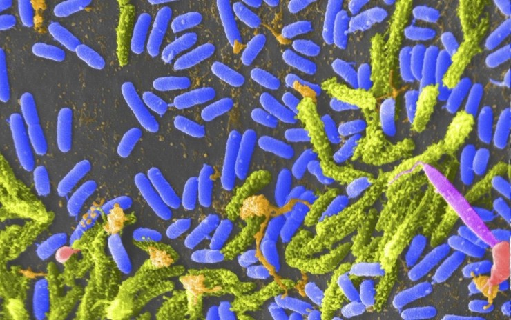 Bacteria Vibrio (azul) que puede causar cólera en humanos. / Europa Press