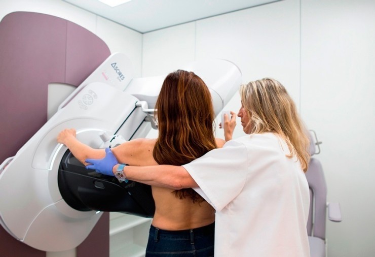 Una mujer se realiza una mamografía de control en el hospital. / Europa Press