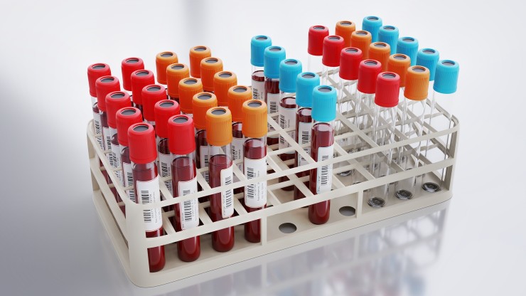 Un simple análisis de sangre o de orina podría detectar hasta catorce tipos de cáncer. / Pixabay.