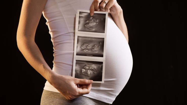 Una mujer embarazada muestra sus ecografías. / Canva